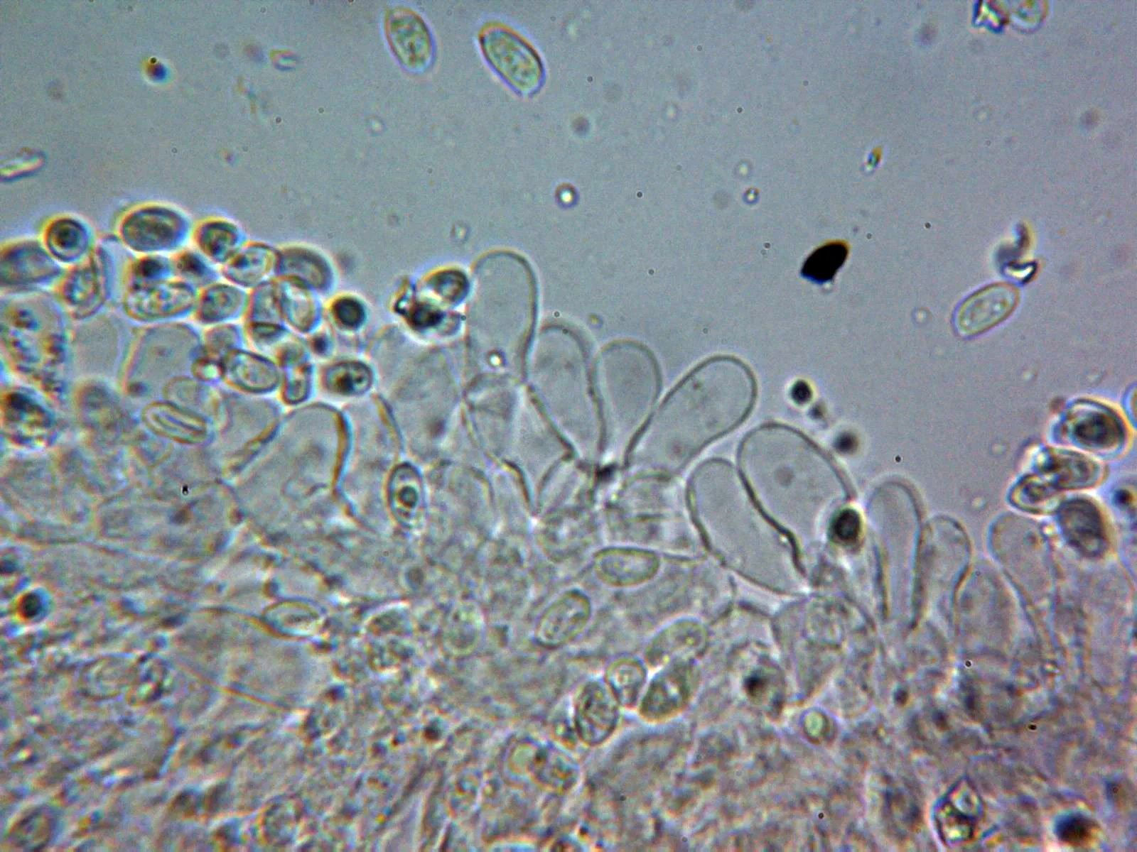Microscopía de Lepiota subincarnata - 10 - Arista amoniaco